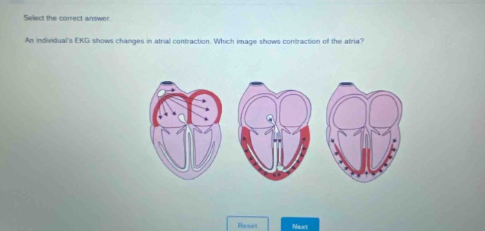 select the correct answer. an individuals ekg shows changes in atrial contraction. which image shows contraction of the atria?