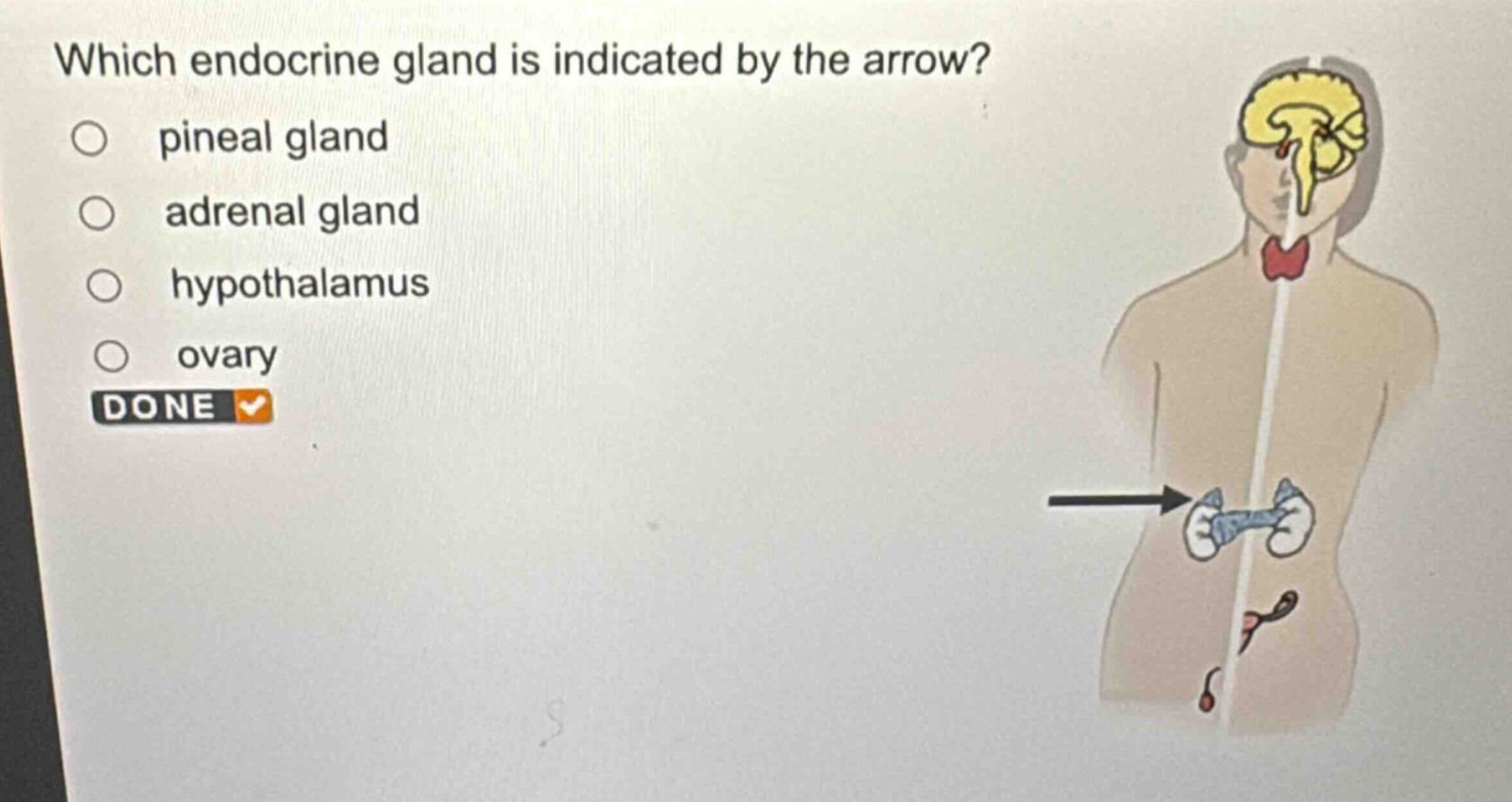 which endocrine gland is indicated by the arrow?\npineal gland\nadrenal gland\nhypothalamus\novary\ndone