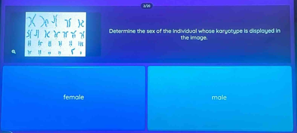 determine the sex of the individual whose karyotype is displayed in the image. female male