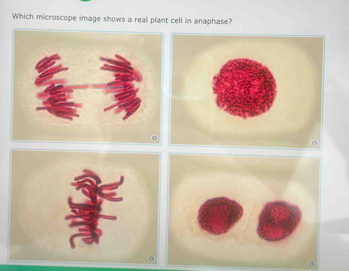 which microscope image shows a real plant cell in anaphase?