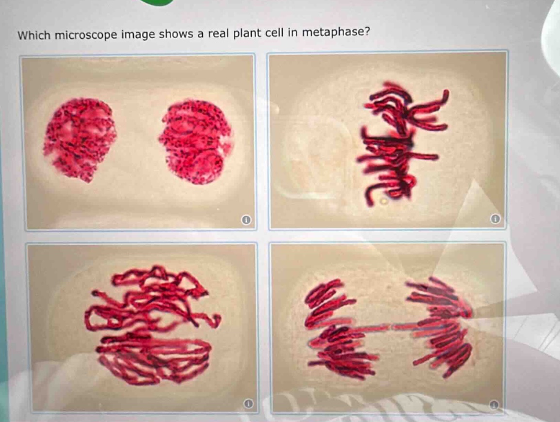 which microscope image shows a real plant cell in metaphase?