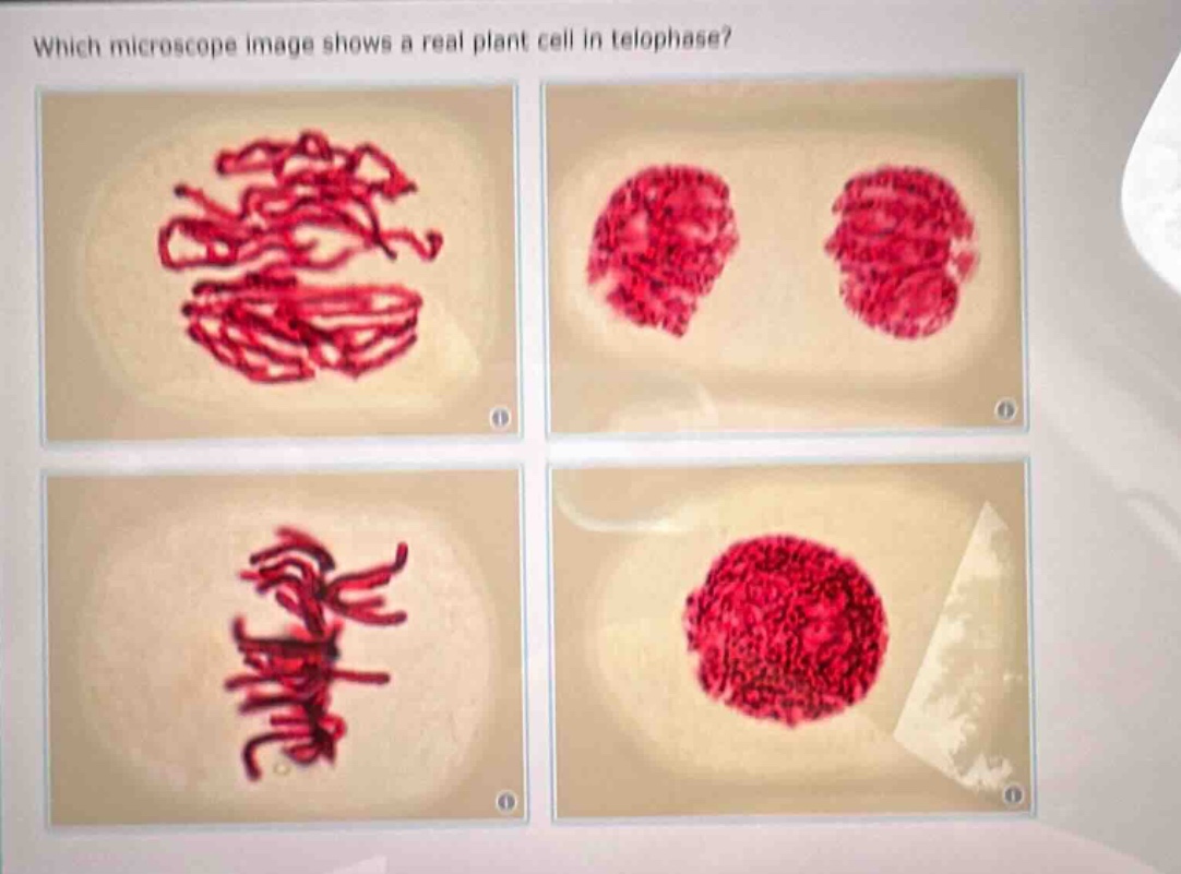 which microscope image shows a real plant cell in telophase?