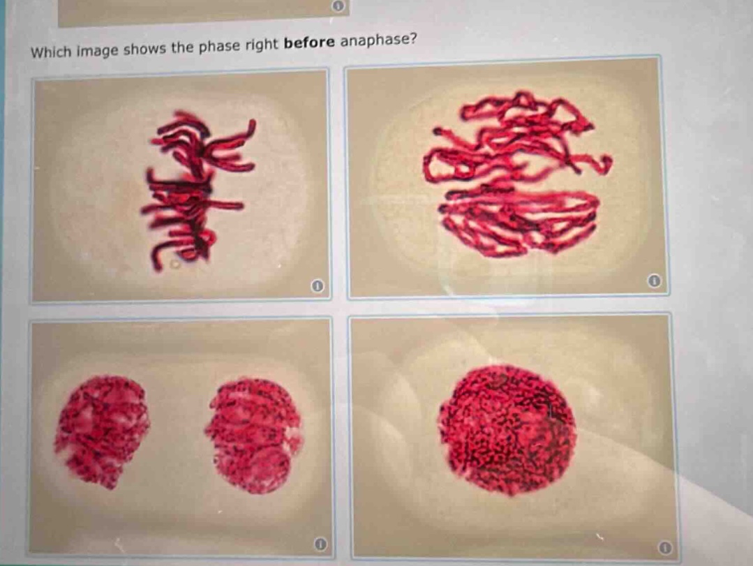 which image shows the phase right before anaphase?