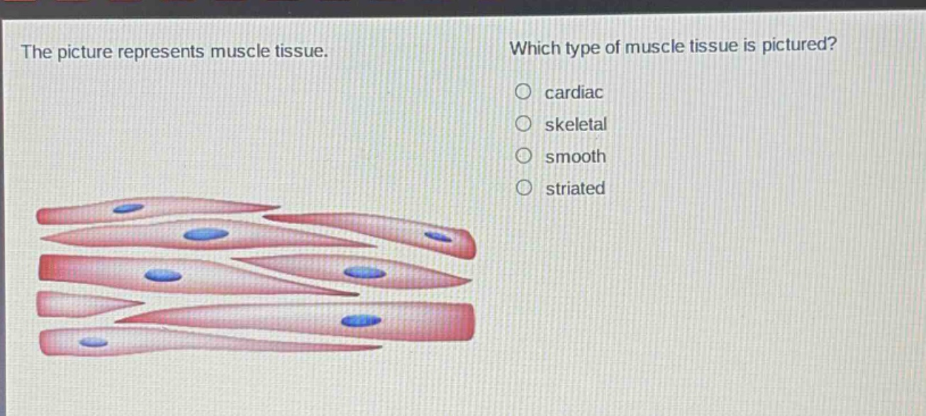 the picture represents muscle tissue. which type of muscle tissue is pictured? cardiac skeletal smooth striated