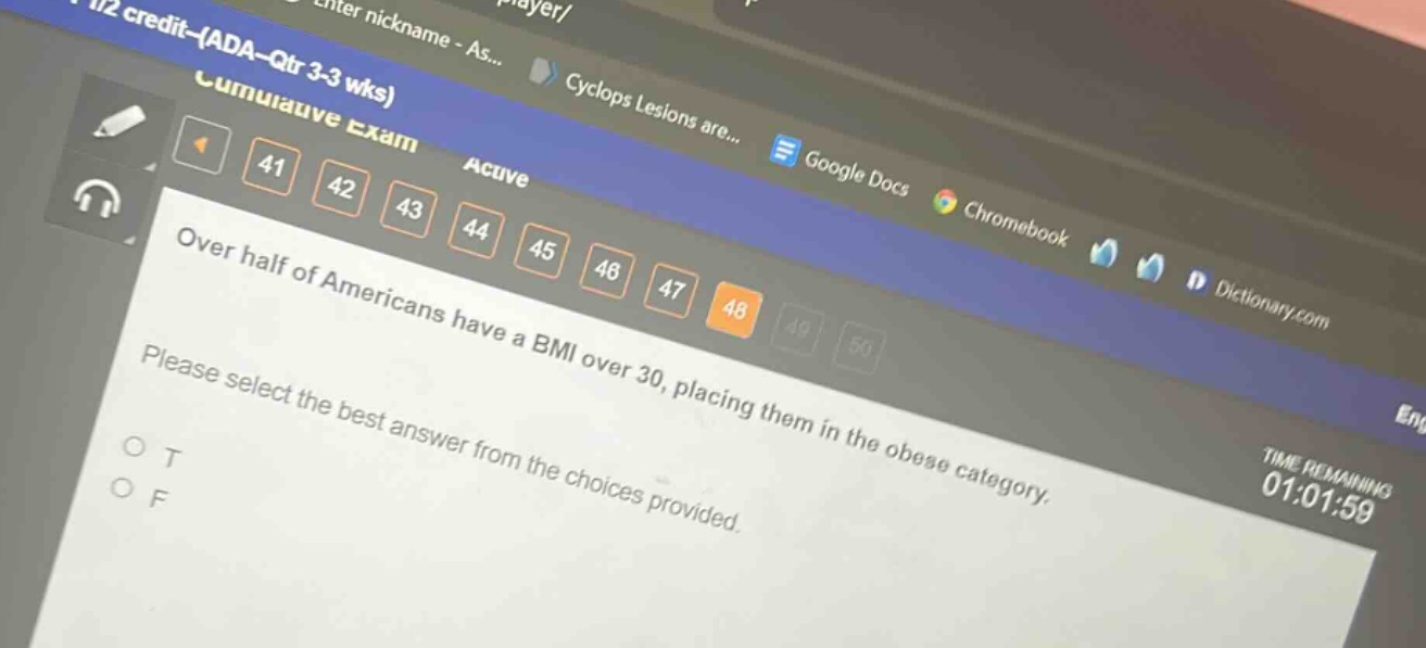 over half of americans have a bmi over 30, placing them in the obese category. please select the best answer from the choices provided. o t o f