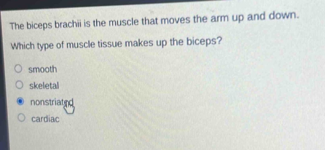 the biceps brachii is the muscle that moves the arm up and down. which type of muscle tissue makes up the biceps? smooth skeletal nonstriated cardiac