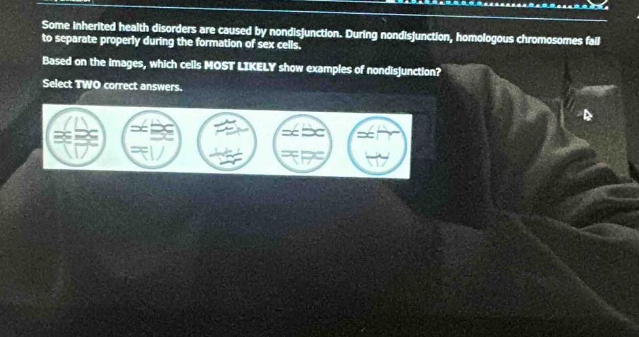some inherited health disorders are caused by nondisjunction. during nondisjunction, homologous chromosomes fail to separate properly during the formation of sex cells. based on the images, which cells most likely show examples of nondisjunction? select two correct answers.
