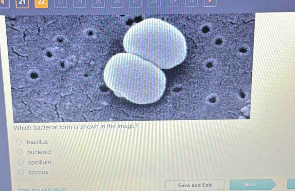 which bacterial form is shown in the image?\nbacillus\nnucleoid\nspirillum\ncoccus