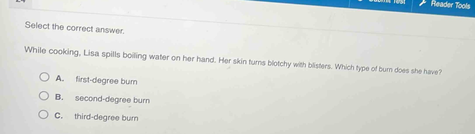 select the correct answer.\nwhile cooking, lisa spills boiling water on her hand. her skin turns blotchy with blisters. which type of burn does she have?\na. first - degree burn\nb. second - degree burn\nc. third - degree burn