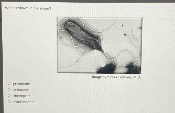 what is shown in the image? image by yutaka tsutsumi, m.d. prokaryote eukaryote chloroplast mitochondrion