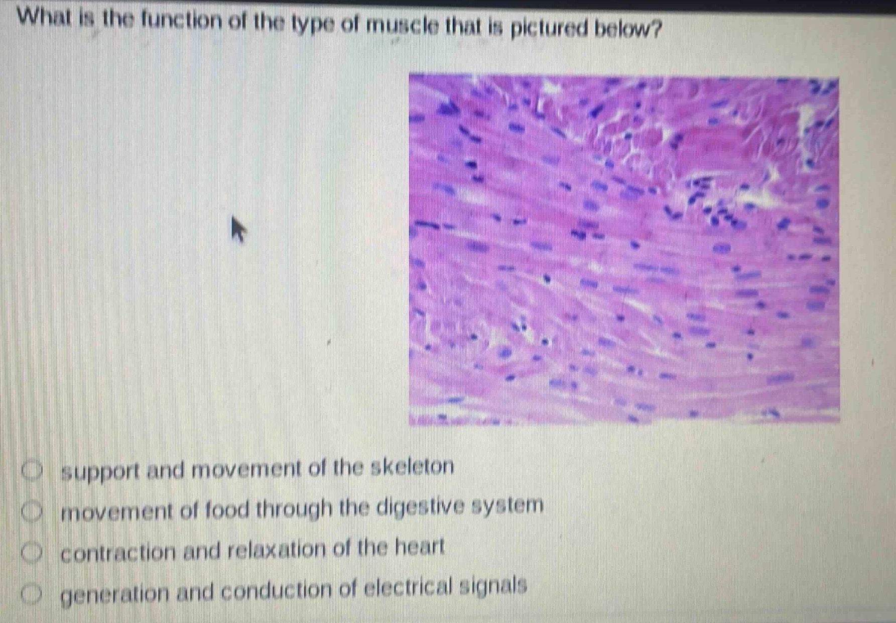 what is the function of the type of muscle that is pictured below?\n○ support and movement of the skeleton\n○ movement of food through the digestive system\n○ contraction and relaxation of the heart\n○ generation and conduction of electrical signals