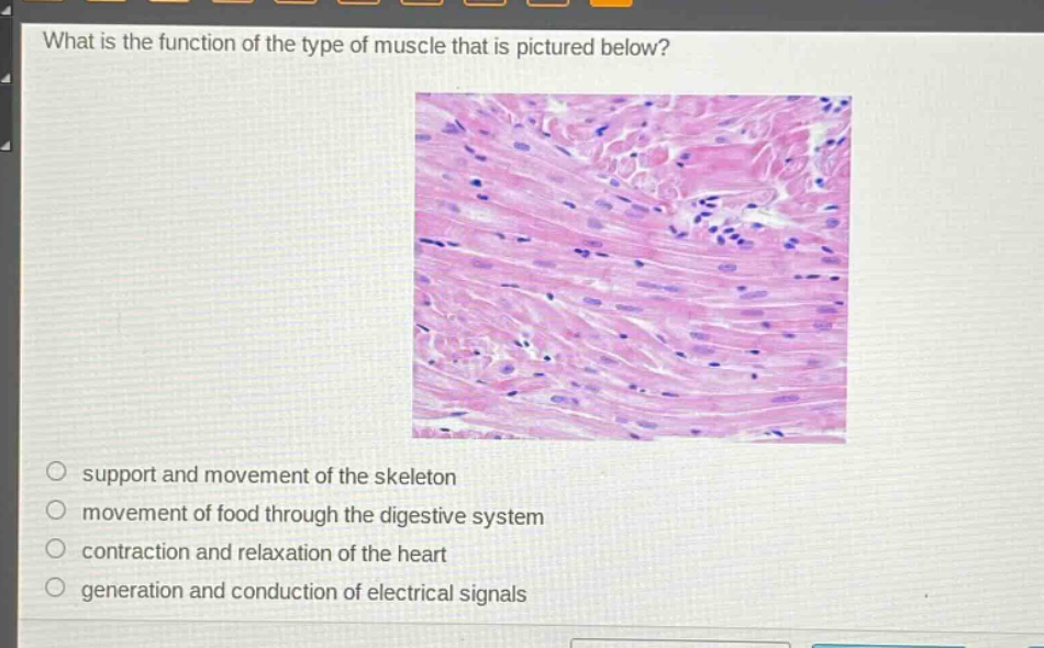 what is the function of the type of muscle that is pictured below?\n support and movement of the skeleton\n movement of food through the digestive system\n contraction and relaxation of the heart\n generation and conduction of electrical signals