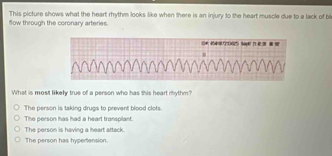 this picture shows what the heart rhythm looks like when there is an injury to the heart muscle due to a lack of blood flow through the coronary arteries. what is most likely true of a person who has this heart rhythm? the person is taking drugs to prevent blood clots. the person has had a heart transplant. the person is having a heart attack. the person has hypertension.