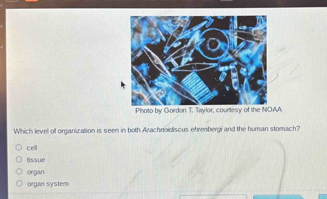 photo by gordon t. taylor, courtesy of the noaa\nwhich level of organization is seen in both arachnoidiscus ehrenbergi and the human stomach?\ncell\ntissue\norgan\norgan system