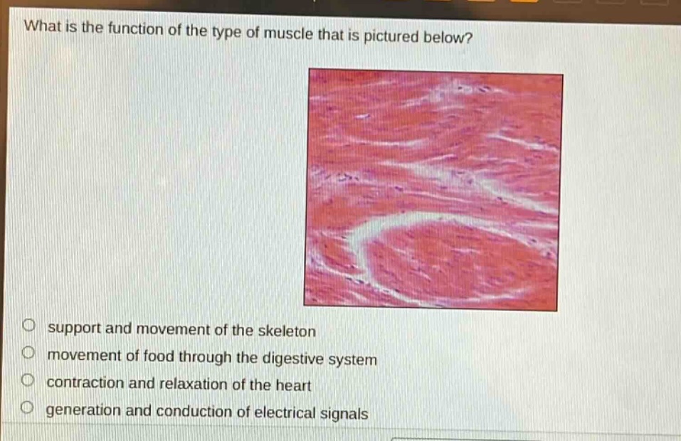 what is the function of the type of muscle that is pictured below?\no support and movement of the skeleton\no movement of food through the digestive system\no contraction and relaxation of the heart\no generation and conduction of electrical signals
