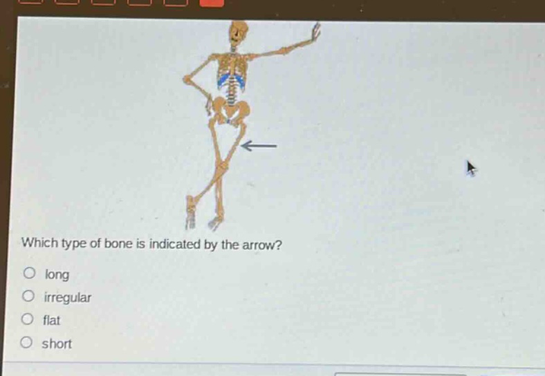 which type of bone is indicated by the arrow?\no long\no irregular\no flat\no short