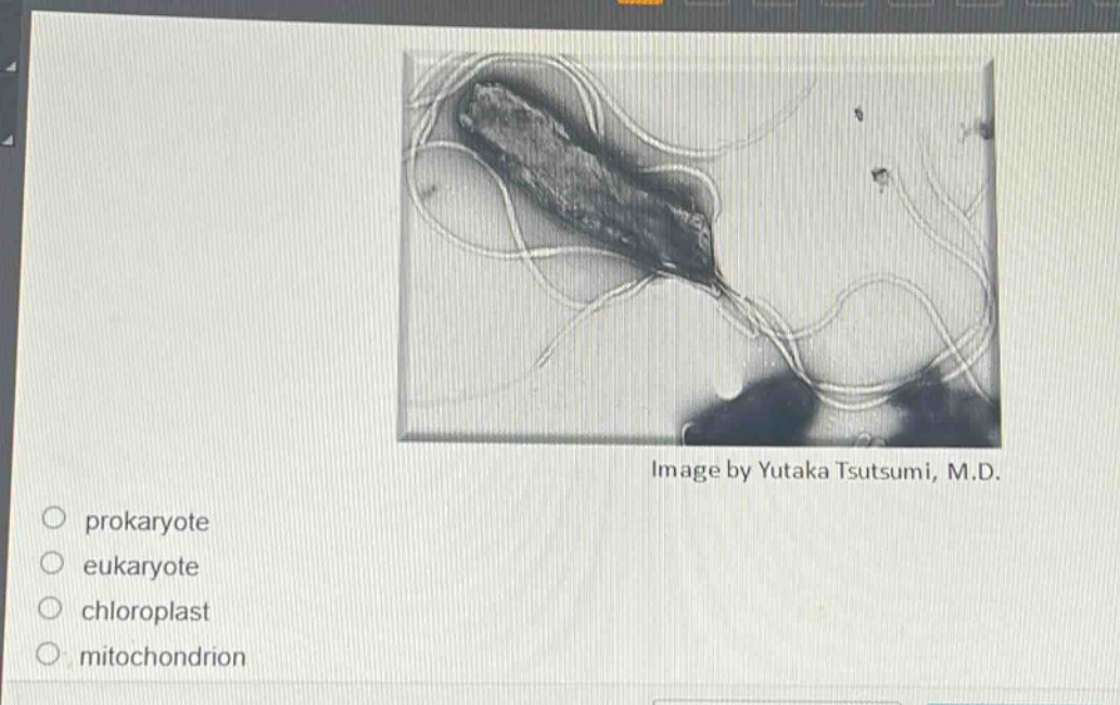 image by yutaka tsutsumi, m.d.\nprokaryote\neukaryote\nchloroplast\nmitochondrion