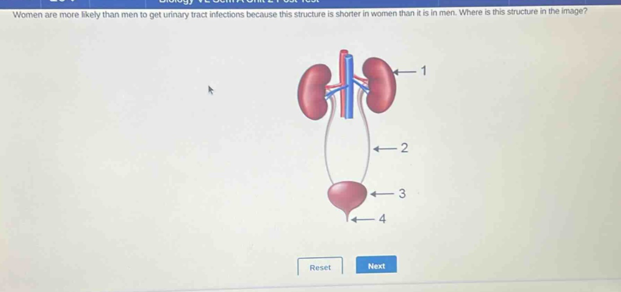 women are more likely than men to get urinary tract infections because this structure is shorter in women than it is in men. where is this structure in the image?