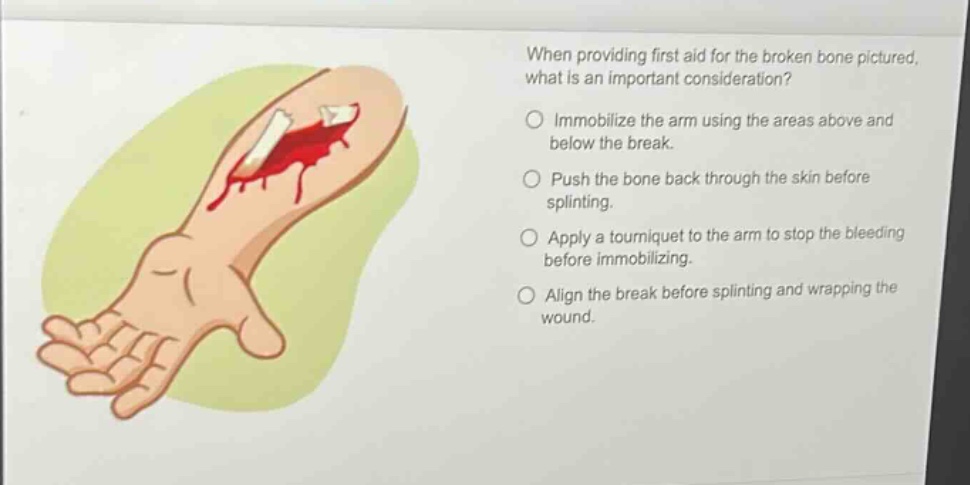 when providing first aid for the broken bone pictured, what is an important consideration?\nimmobilize the arm using the areas above and below the break.\npush the bone back through the skin before splinting.\napply a tourniquet to the arm to stop the bleeding before immobilizing.\nalign the break before splinting and wrapping the wound.