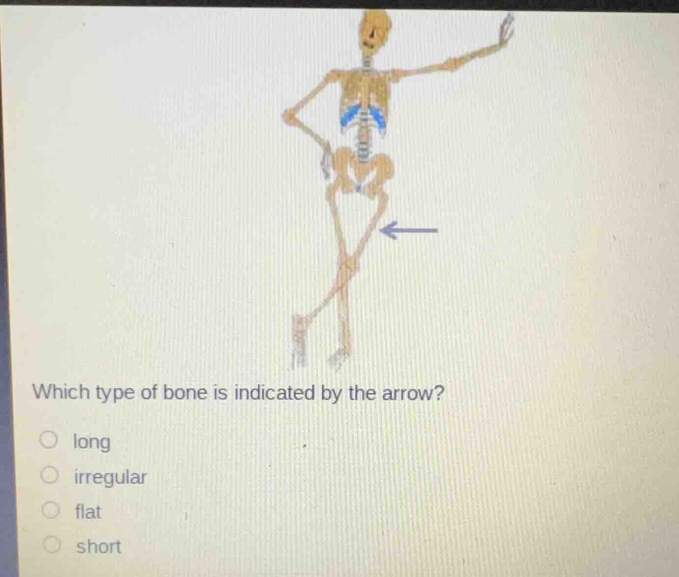 which type of bone is indicated by the arrow? ○ long ○ irregular ○ flat…