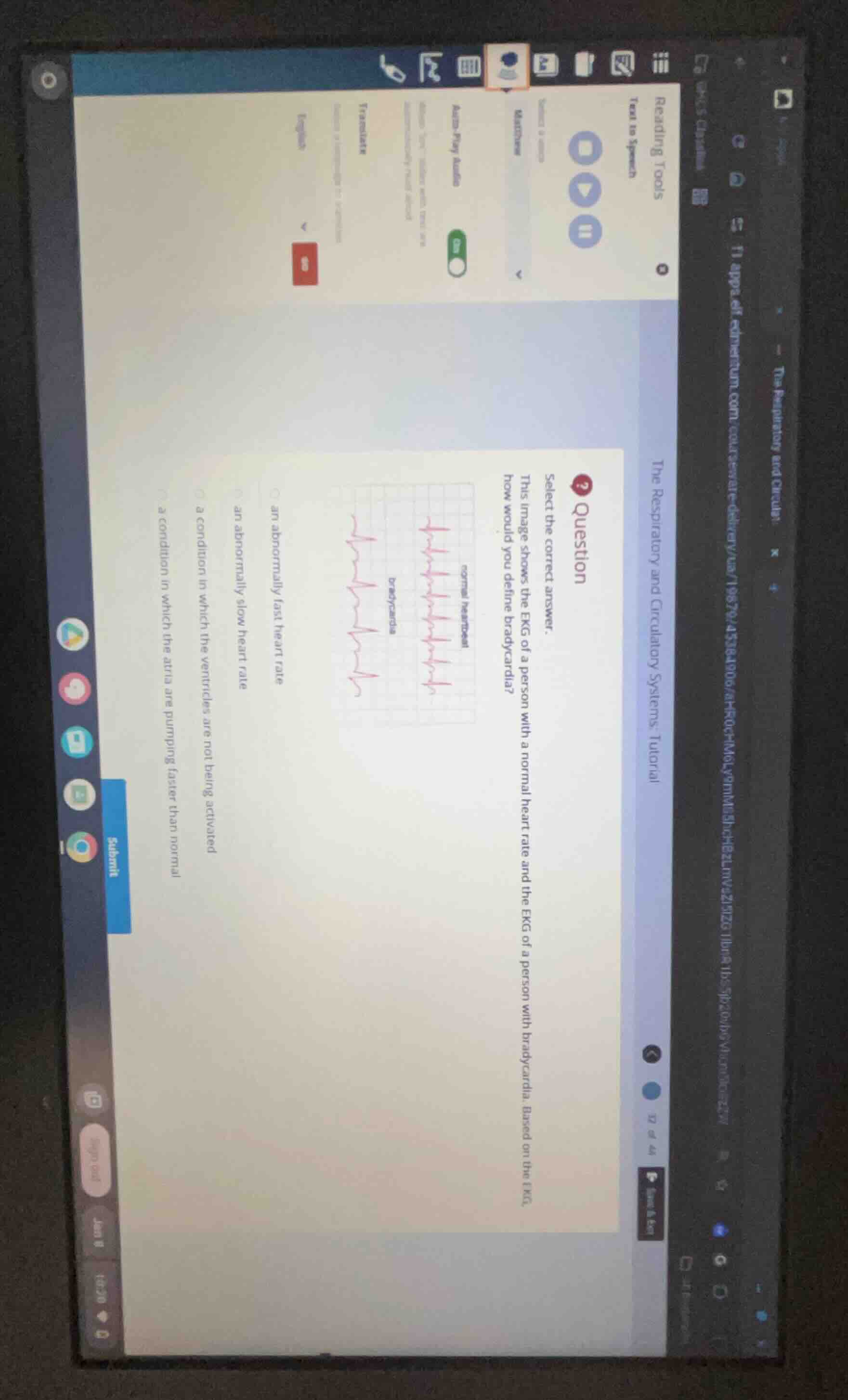 question select the correct answer. this image shows the ekg of a perso…