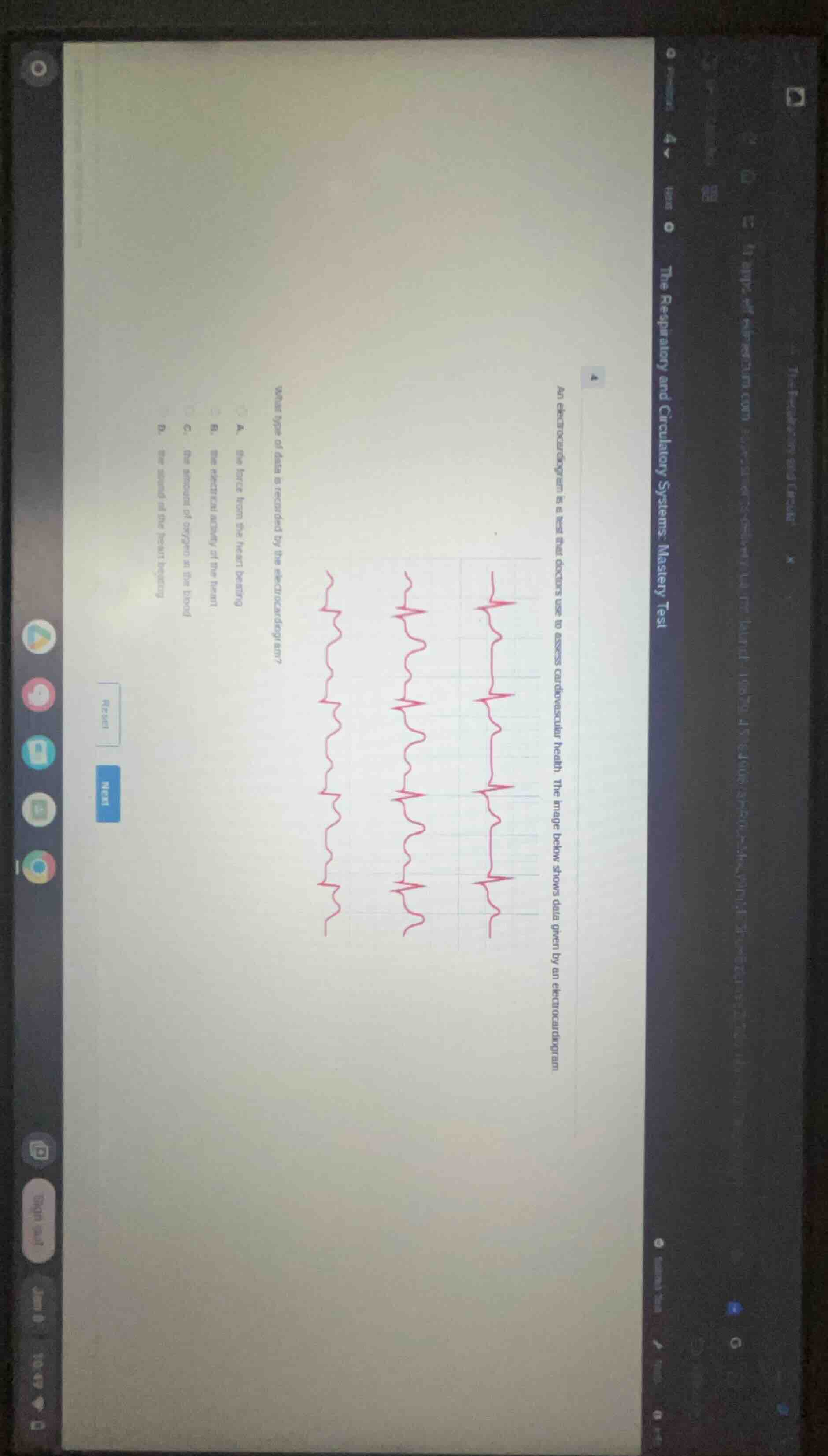 an electrocardiogram is a test that doctors use to assess cardiovascula…
