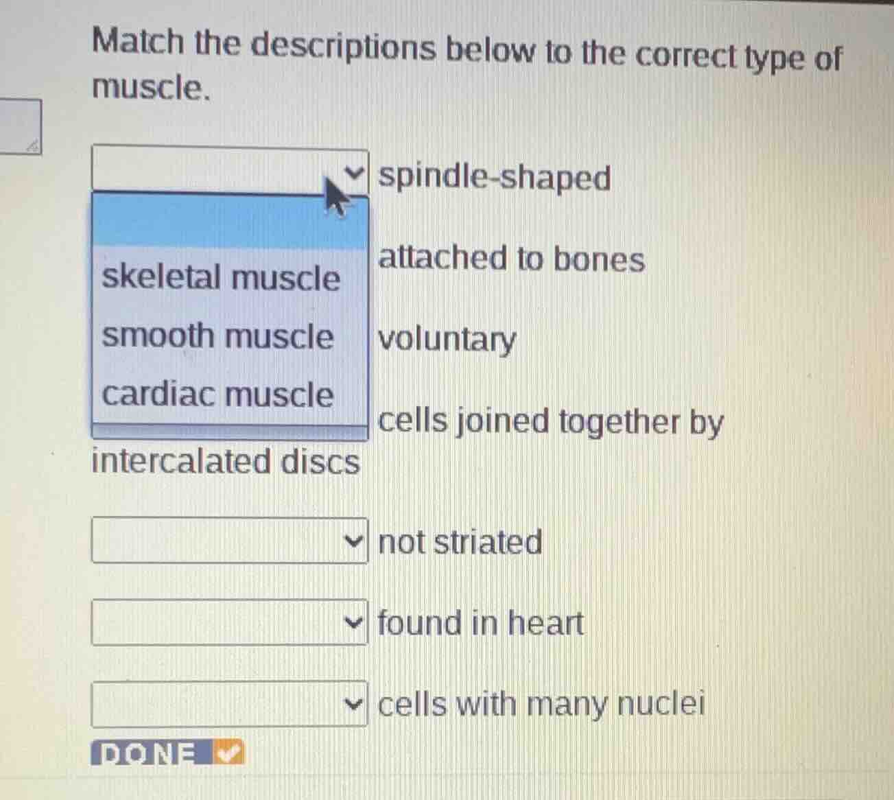 match the descriptions below to the correct type of muscle. spindle - s…