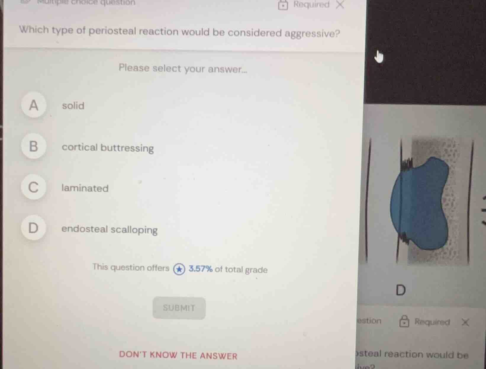 which type of periosteal reaction would be considered aggressive? pleas…