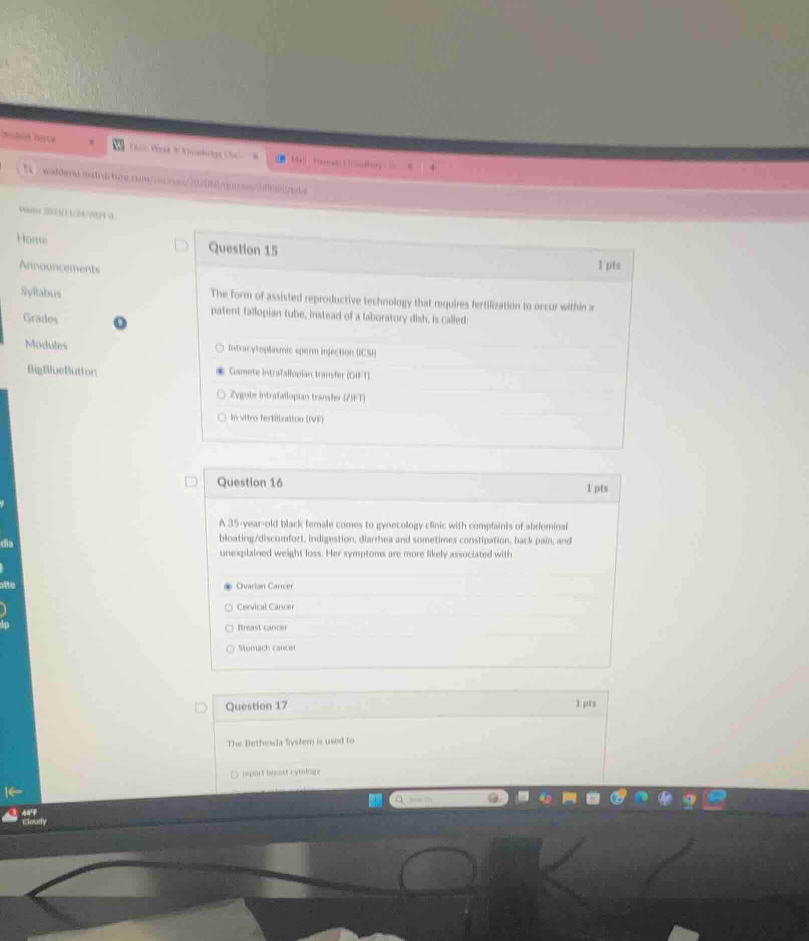 question 15 1 pts the form of assisted reproductive technology that req…