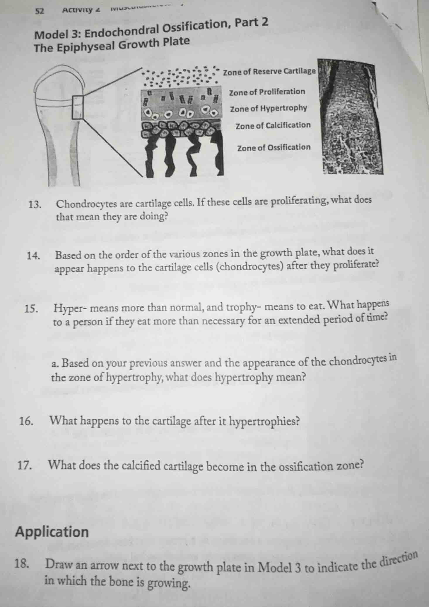 model 3: endochondral ossification, part 2 the epiphyseal growth plate …