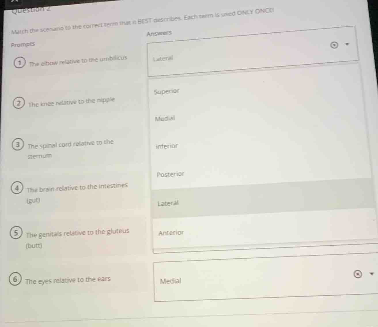 question 2 match the scenario to the correct term that it best describe…