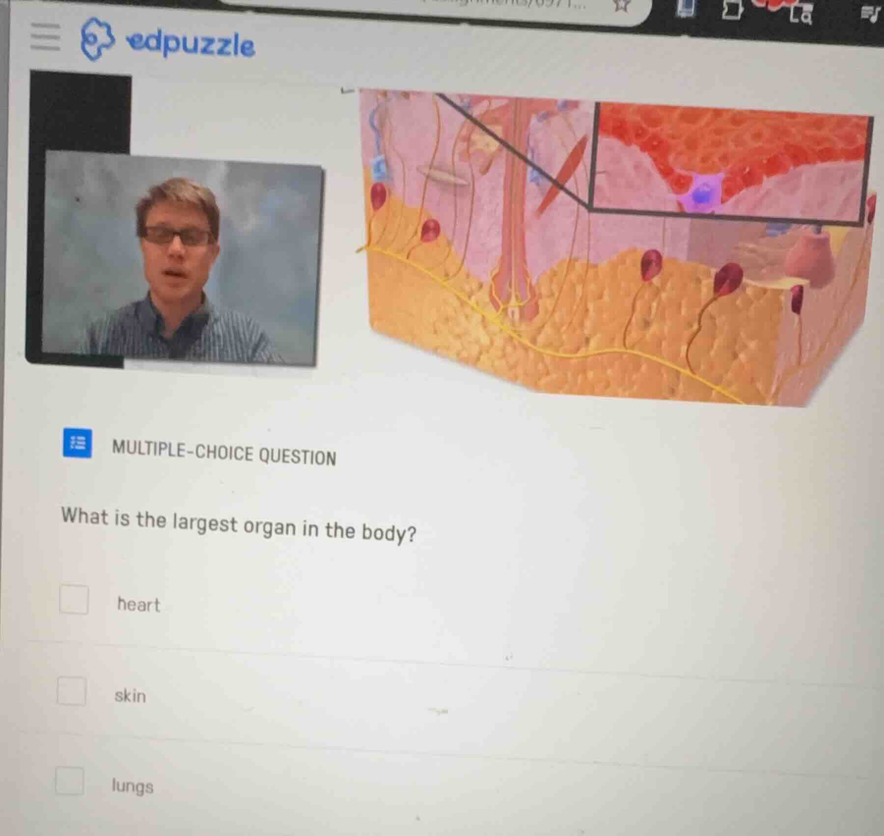 multiple-choice question what is the largest organ in the body? heart s…