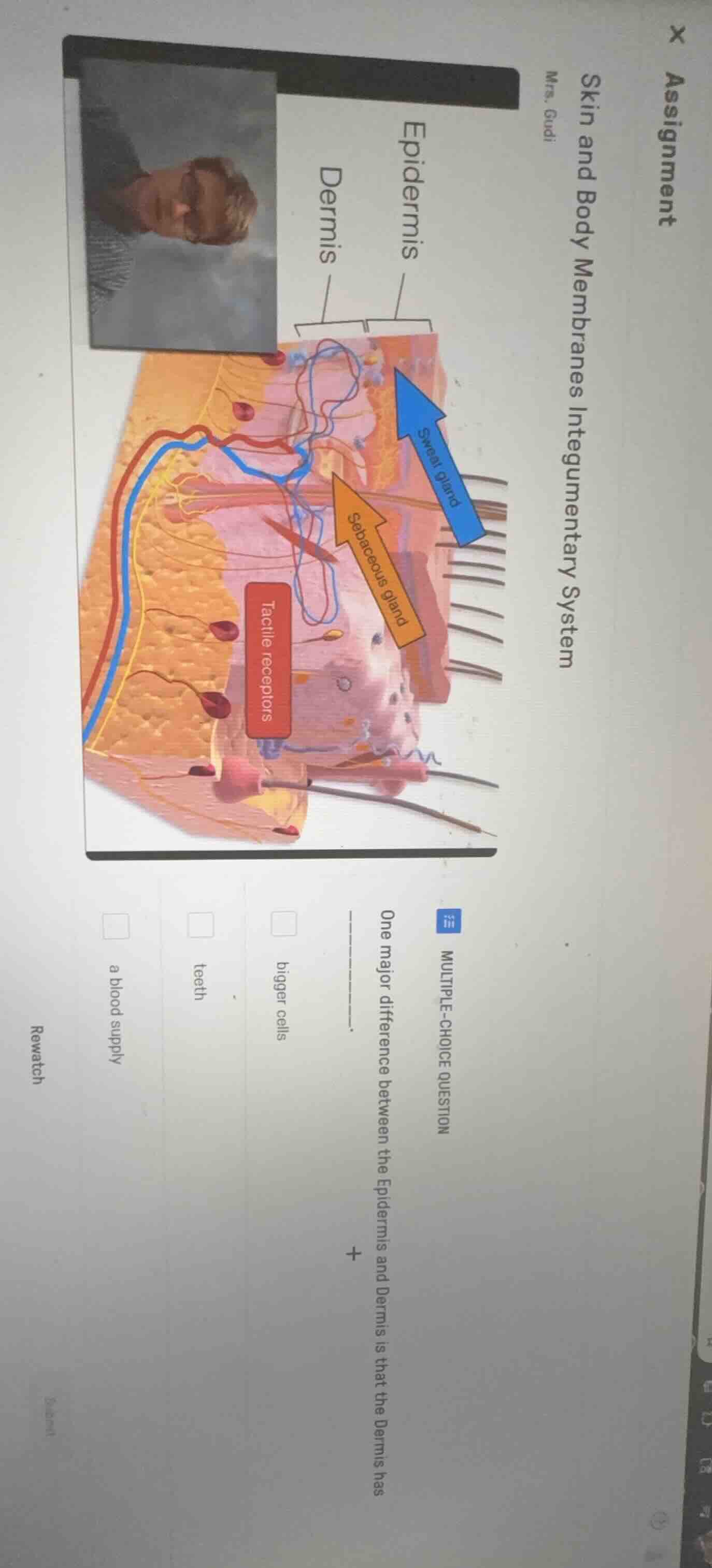 multiple-choice question one major difference between the epidermis and…
