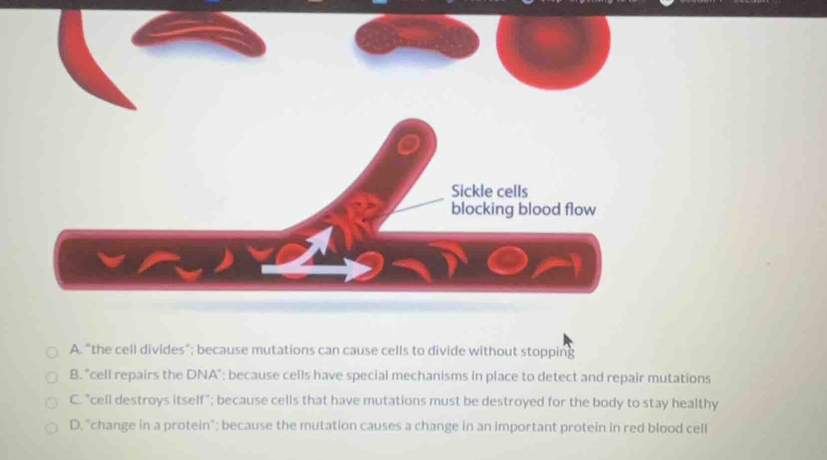 sickle cells blocking blood flow a. \the cell divides\; because mutatio…