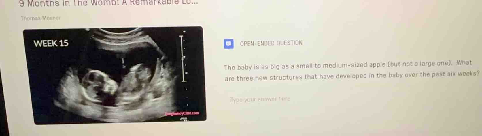 9 months in the womb: a remarkable lo... thomas mosner open - ended que…