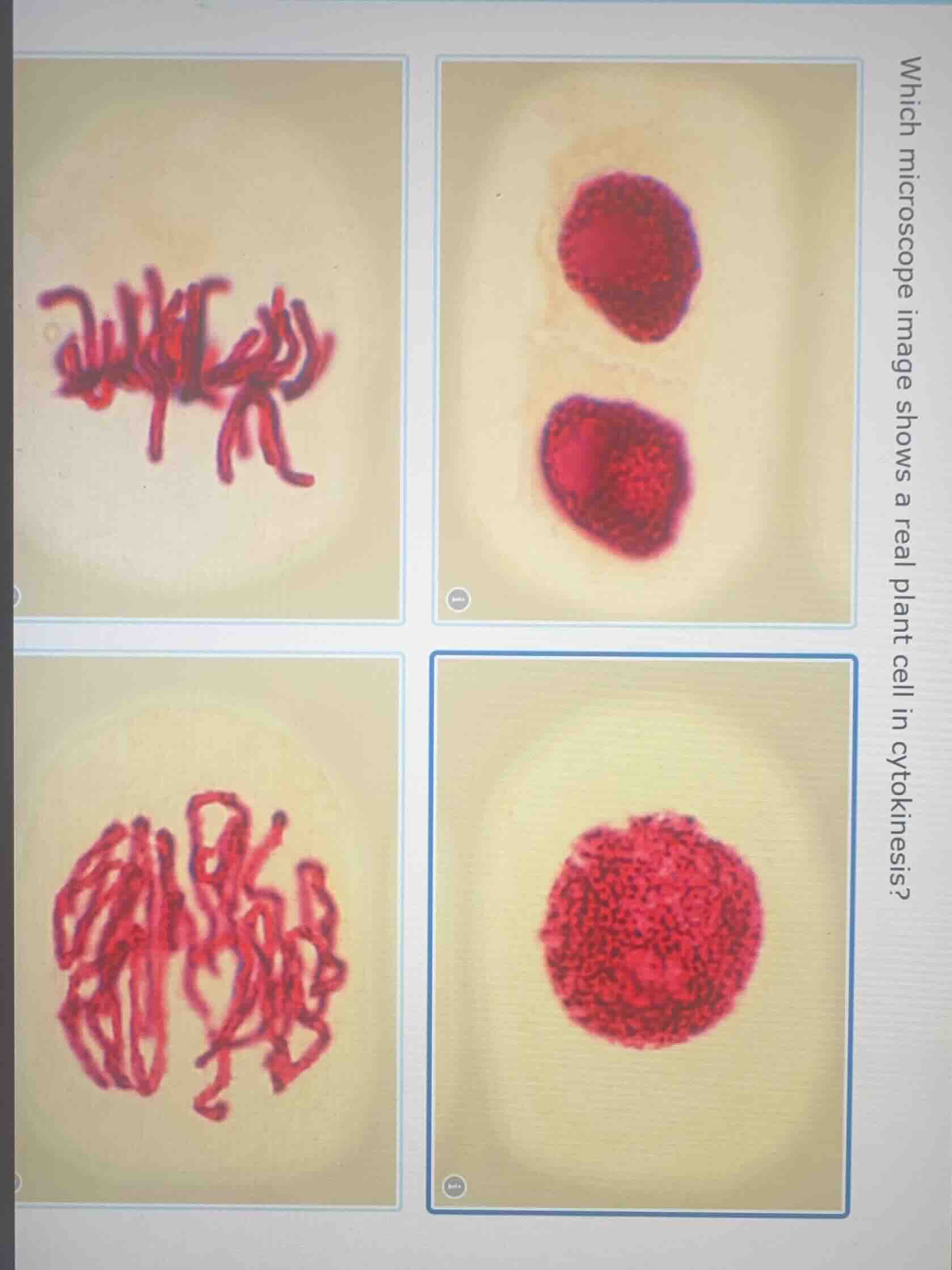 which microscope image shows a real plant cell in cytokinesis?