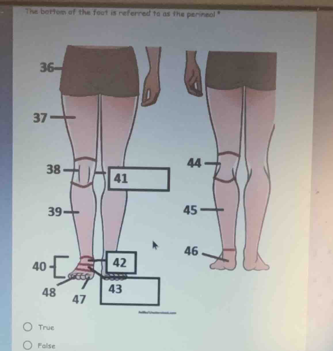 the bottom of the foot is referred to as the perineal? true false