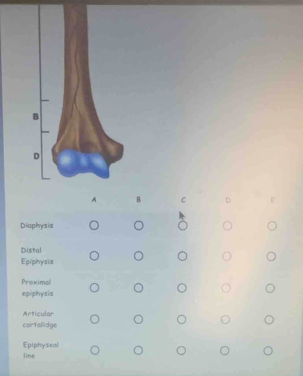 diaphysis distal epiphysis proximal epiphysis articular cartalidge epip…