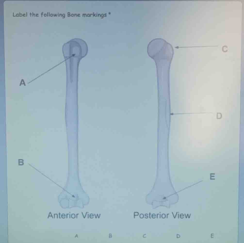 label the following bone markings * anterior view posterior view a b c …
