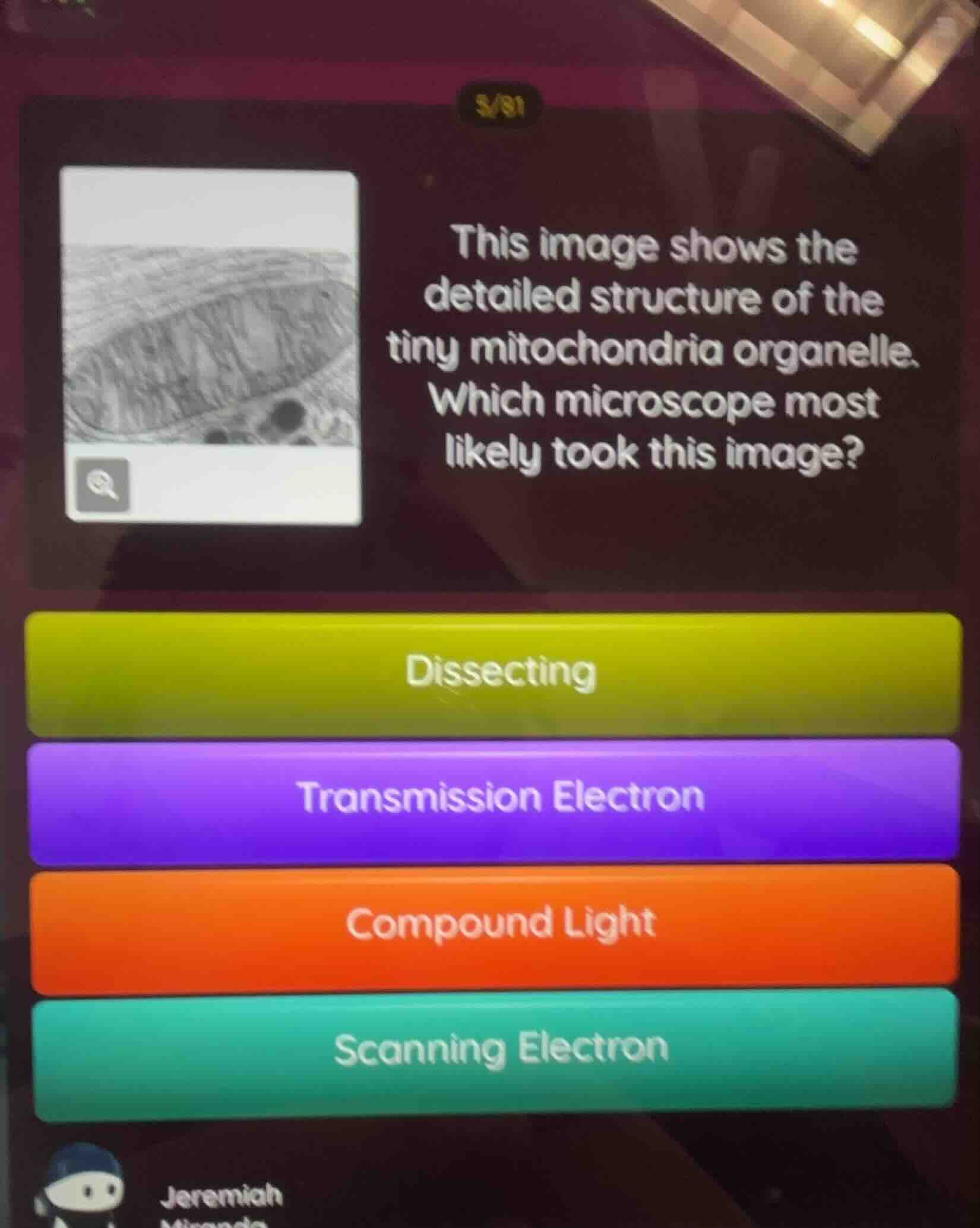 this image shows the detailed structure of the tiny mitochondria organe…