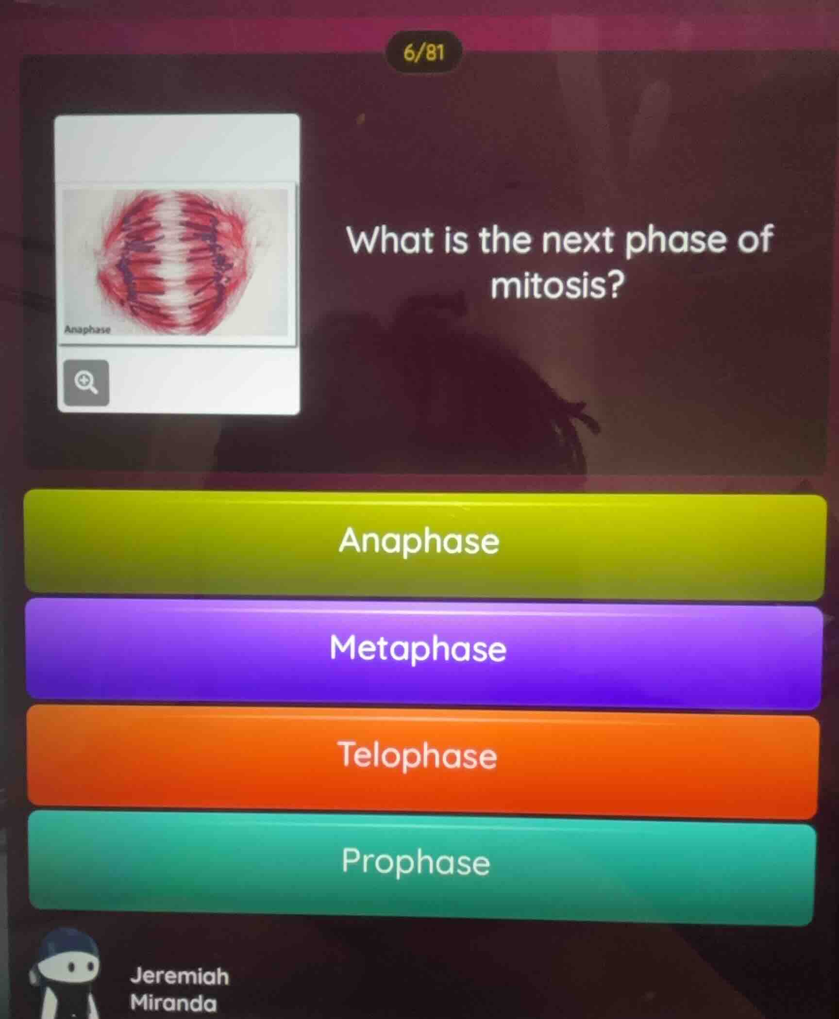 what is the next phase of mitosis? anaphase metaphase telophase prophase