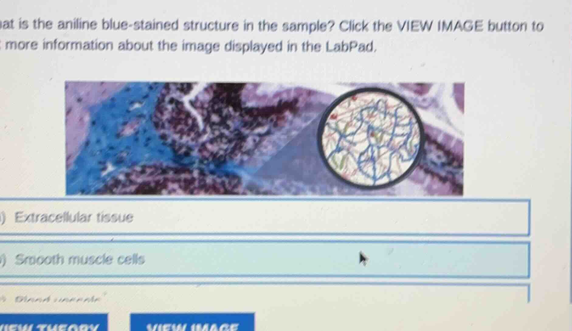 what is the aniline blue - stained structure in the sample? click the v…