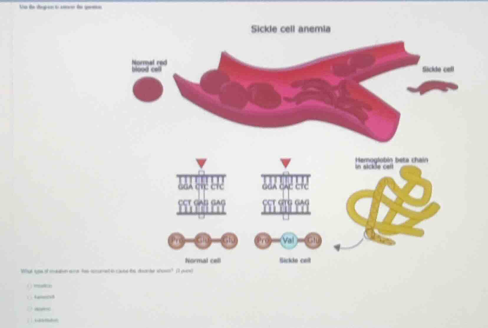 use the diagram to answer the question. sickle cell anemia what type of…