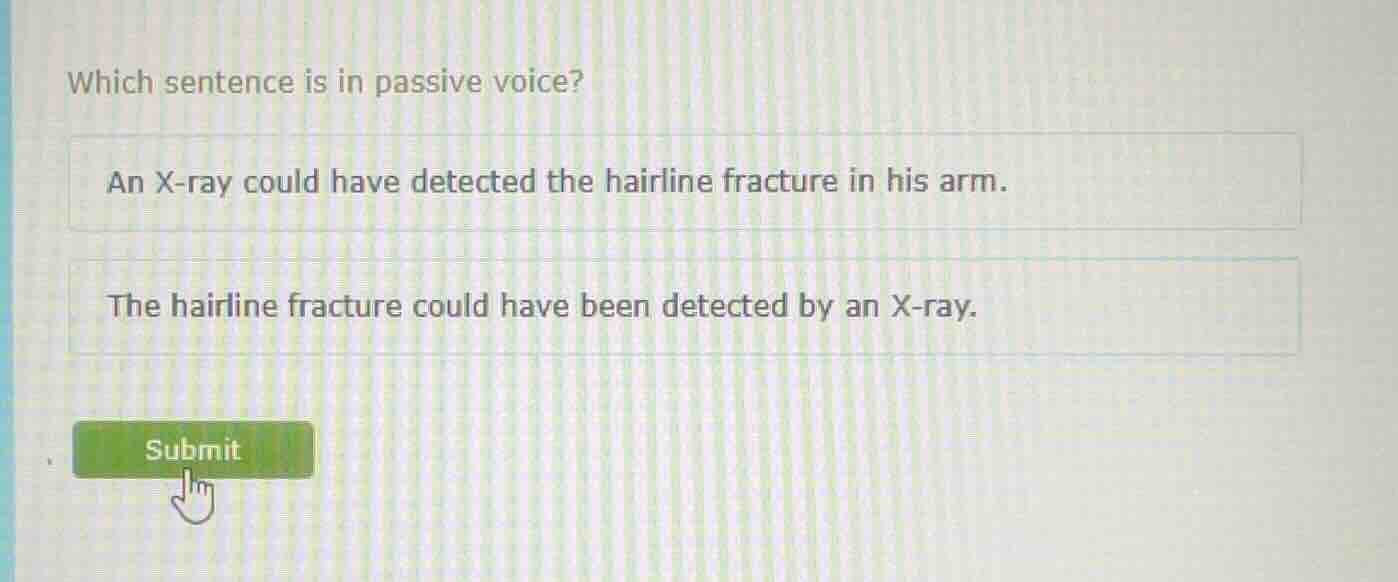 which sentence is in passive voice? an x - ray could have detected the …