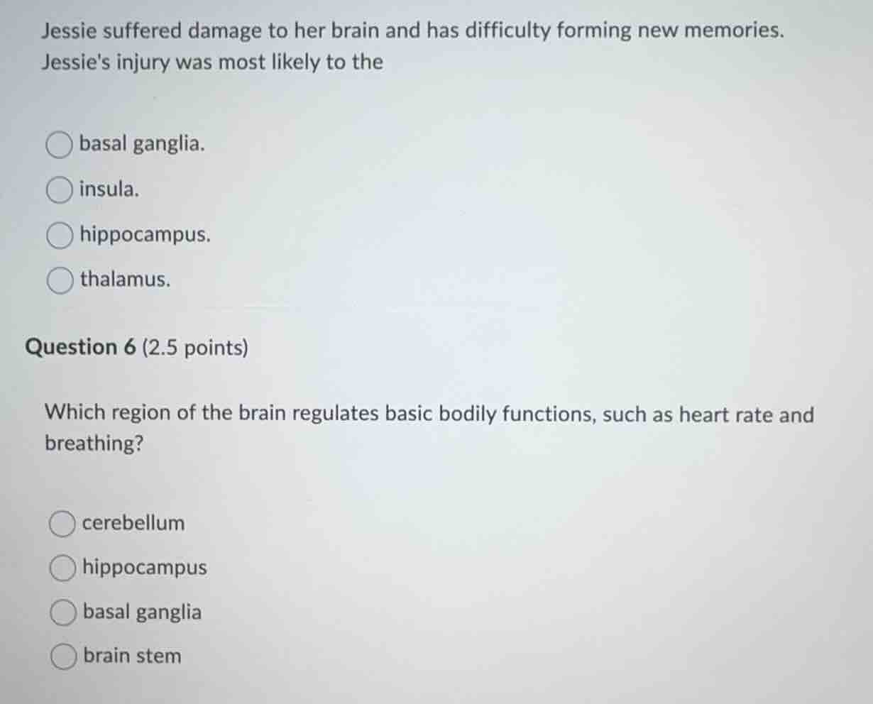 jessie suffered damage to her brain and has difficulty forming new memo…