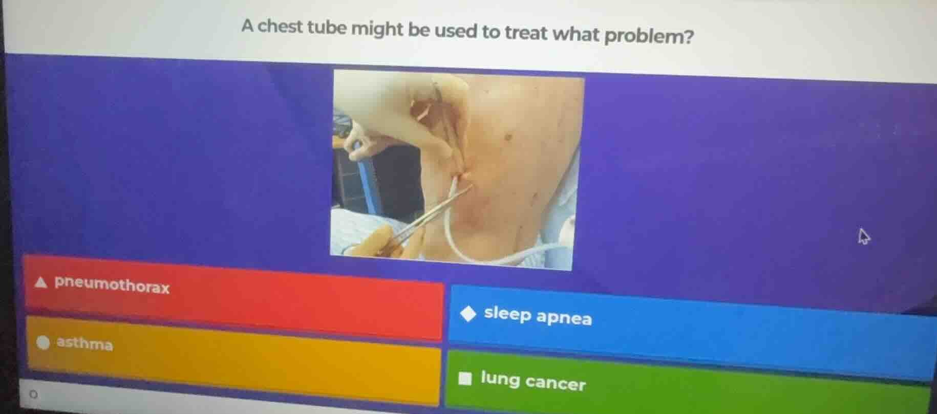 a chest tube might be used to treat what problem? pneumothorax sleep ap…