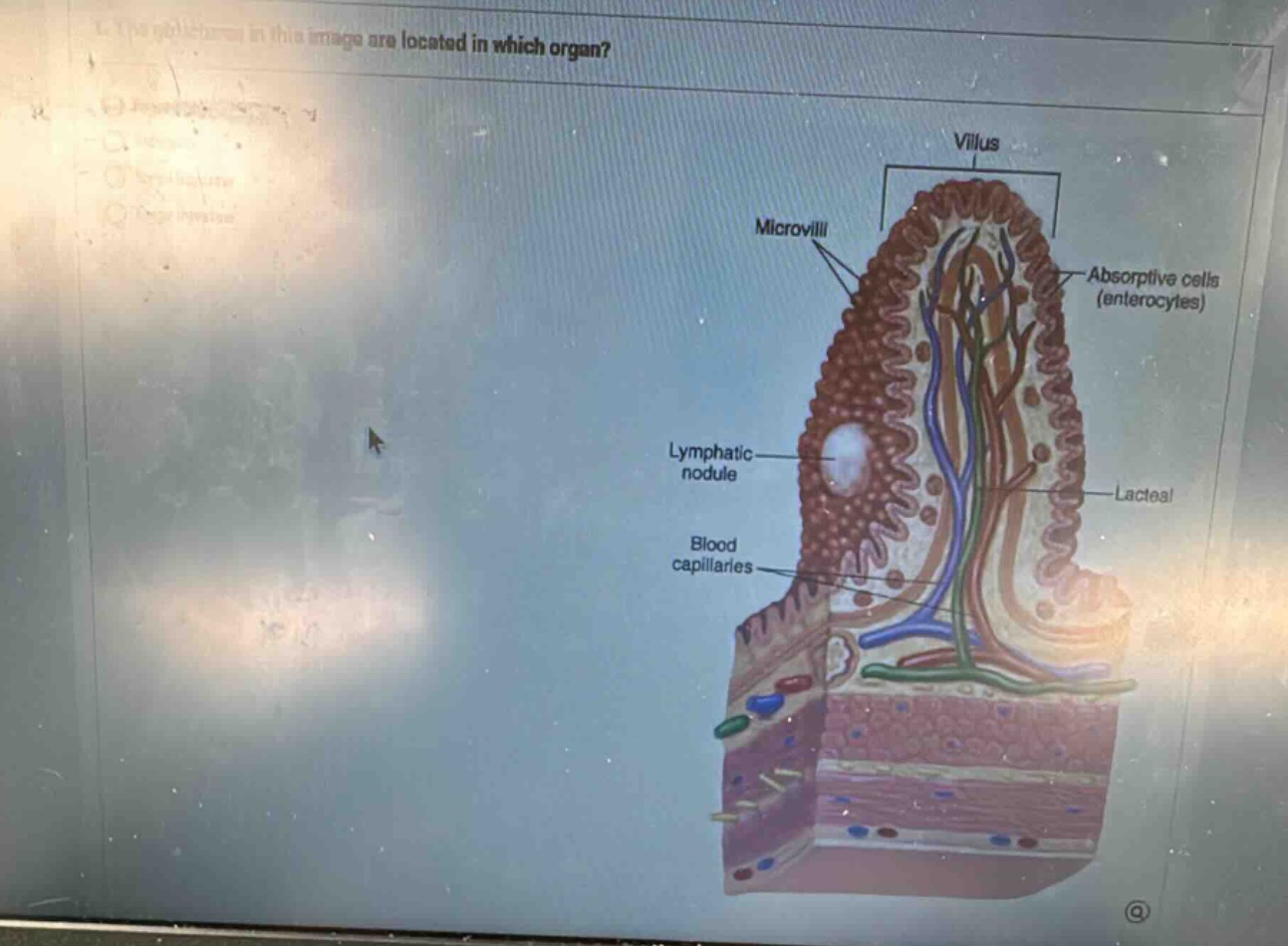 the structures in this image are located in which organ? options (parti…