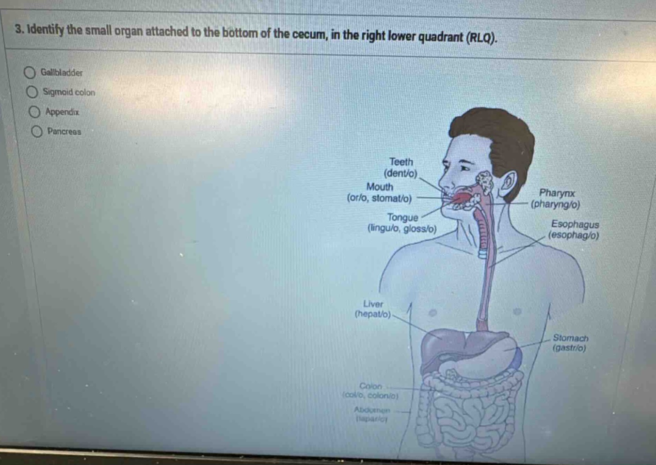 3. identify the small organ attached to the bottom of the cecum, in the…