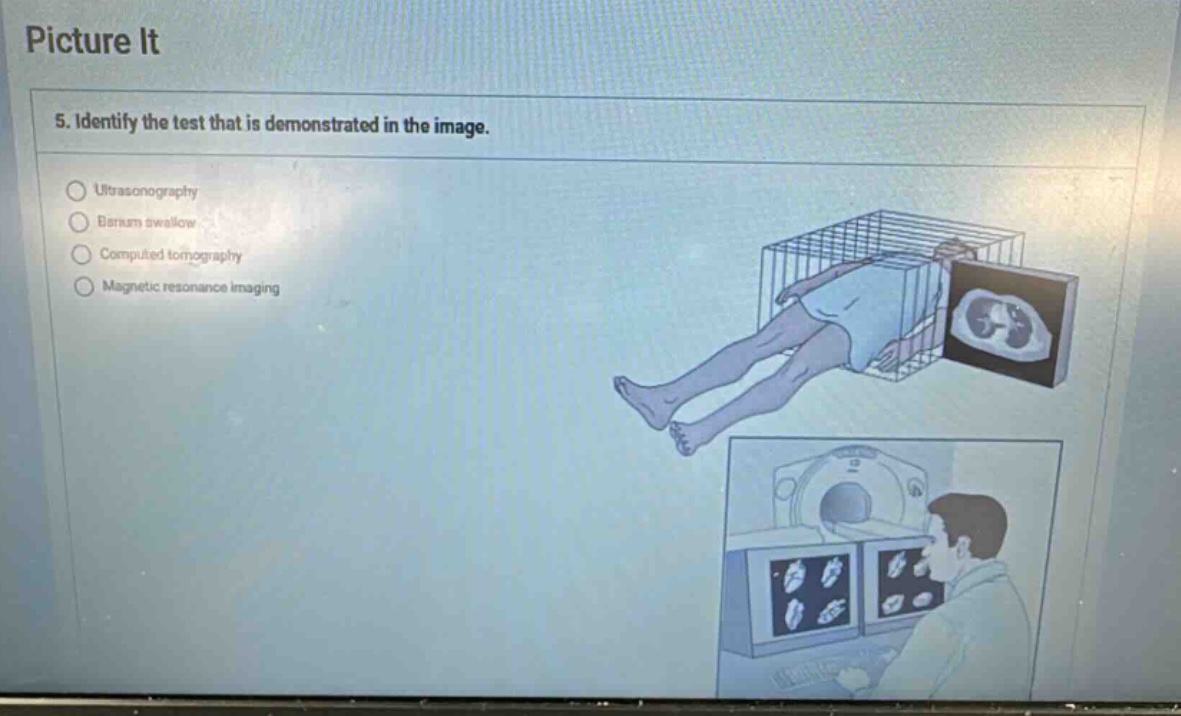 picture it 5. identify the test that is demonstrated in the image. ultr…