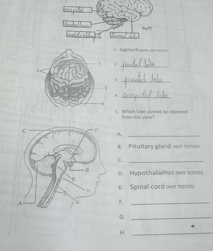 1. sagittal fissure (not tested) 2. 3. 4. 5. which lobe cannot be obser…